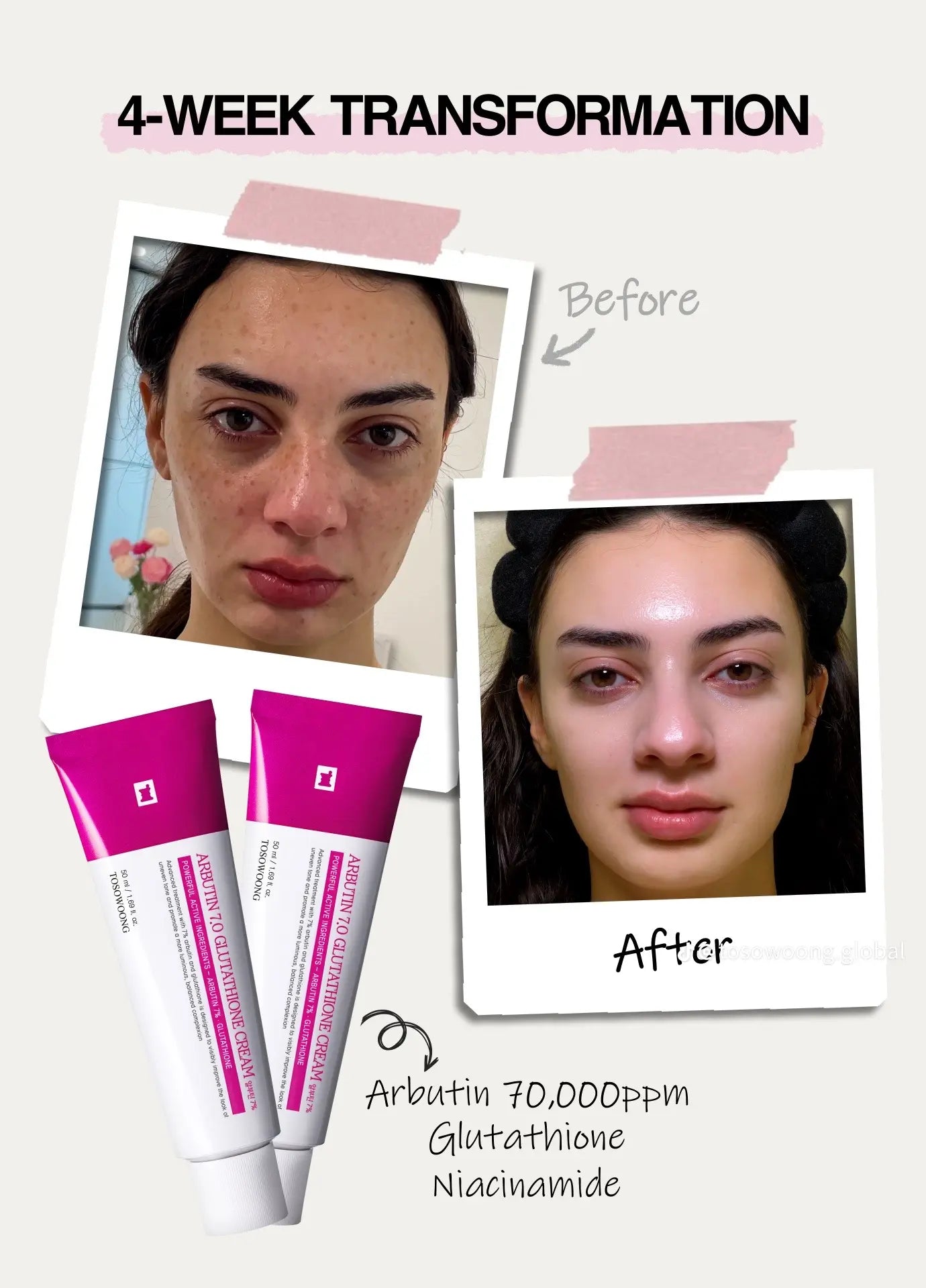 Arbutin Skincare Cream.