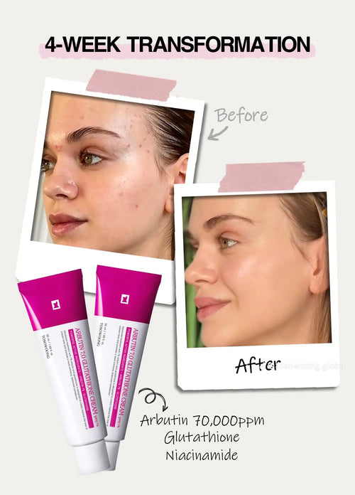 Arbutin Skincare Cream.